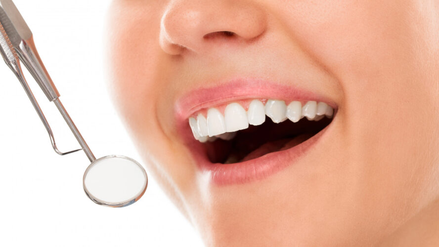 Saiba como identificar qual é o melhor implante dentário